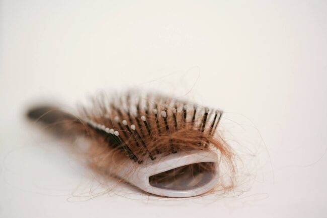 299428-revisor-entregar-ate-as-18h-do-dia-97-conheca-x-tratamentos-para-queda-de-cabelo